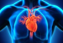 Diagnosis And Treatment for Heart Disease