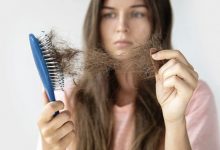 does stress cause hair loss -Stress Hair Loss Treatment That Really Works?