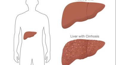 Best Liver Hospitals in Istanbul