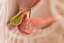 Bladder Cancer Treatment