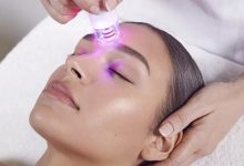 microneedling