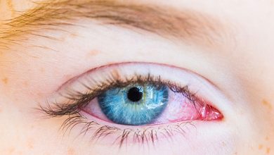 Conjunctivitis - Featured Image