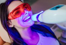 smile teeth whitening